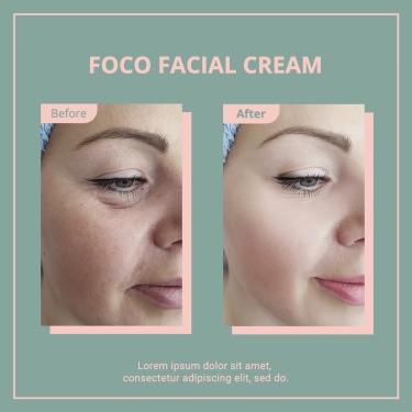 Simple Facial Cream Users Feedback Ecommerce Product Image