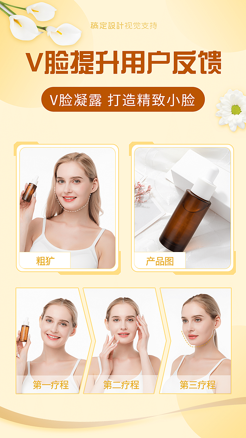 V脸提升效果全程效果展示对比图