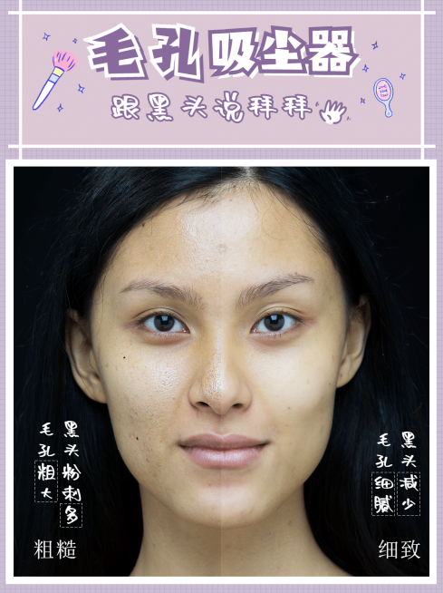 小红书护肤品种草前后对比图预览效果