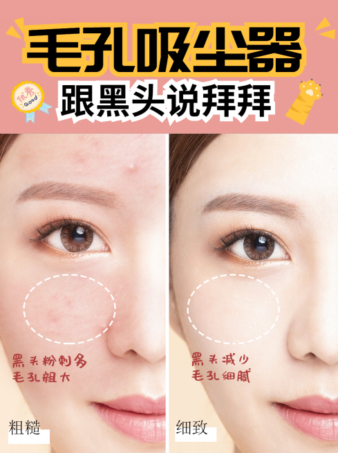 小红书护肤品营销种草前后对比图预览效果